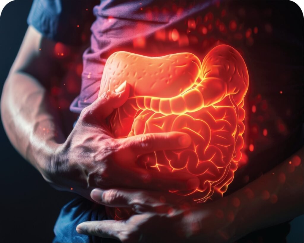 pharmazon homecare IBD