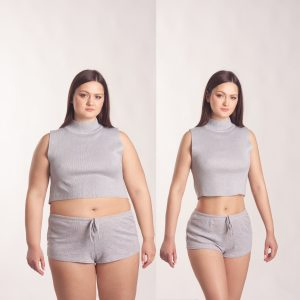 obesity 2