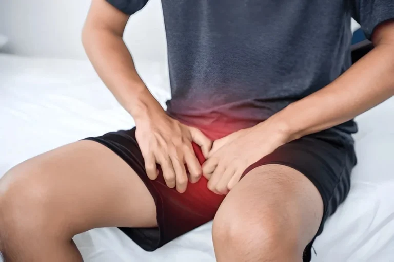 jock-itch